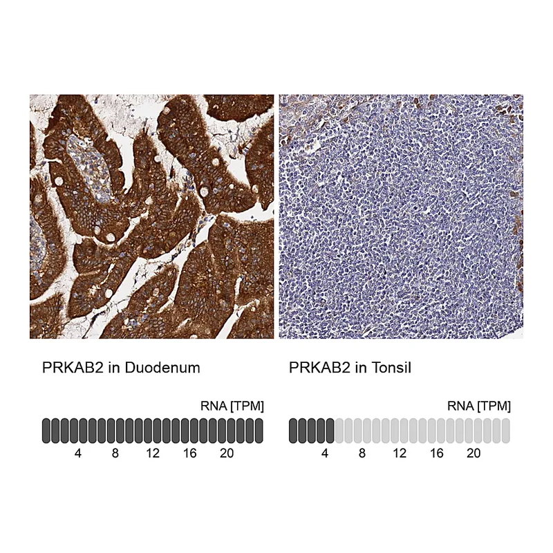 Atlas Antibodies Anti-PRKAB2 Antibody