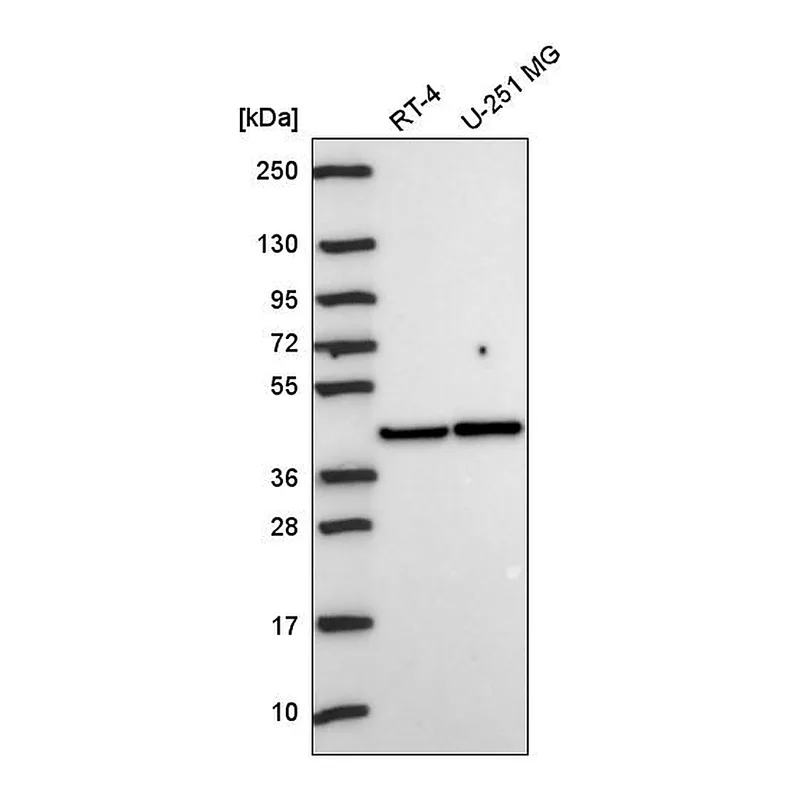 Atlas Antibodies Anti-PRKACA Antibody