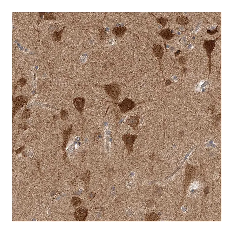 Atlas Antibodies Anti-PRKAR1B Antibody