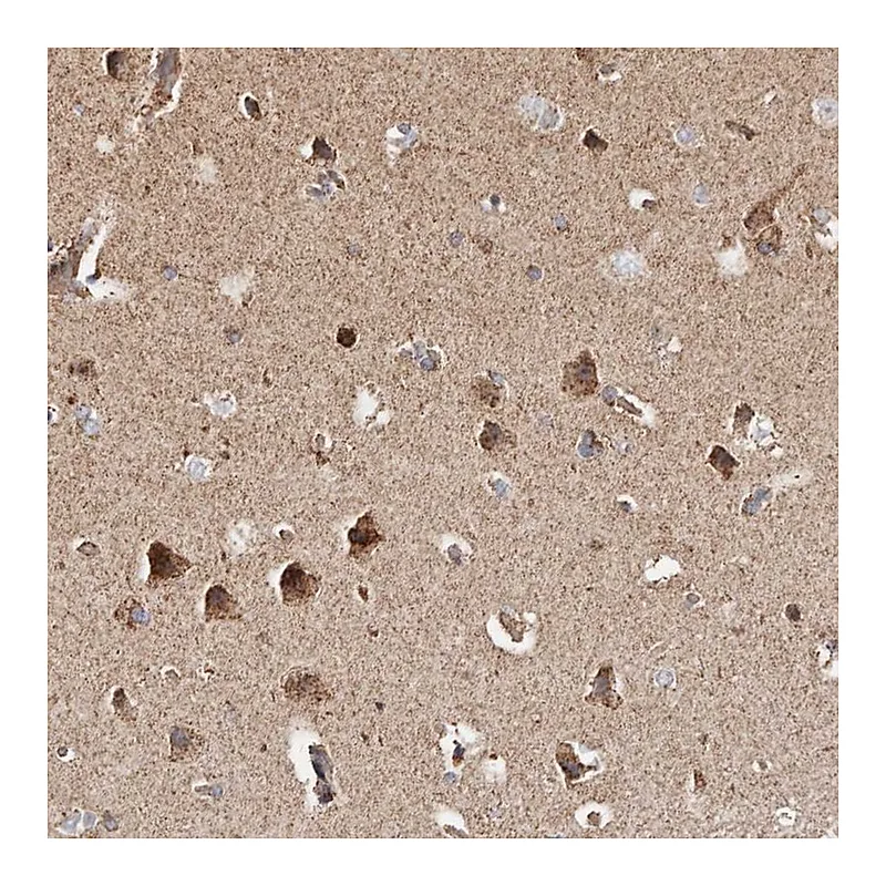 Atlas Antibodies Anti-PRKACB Antibody