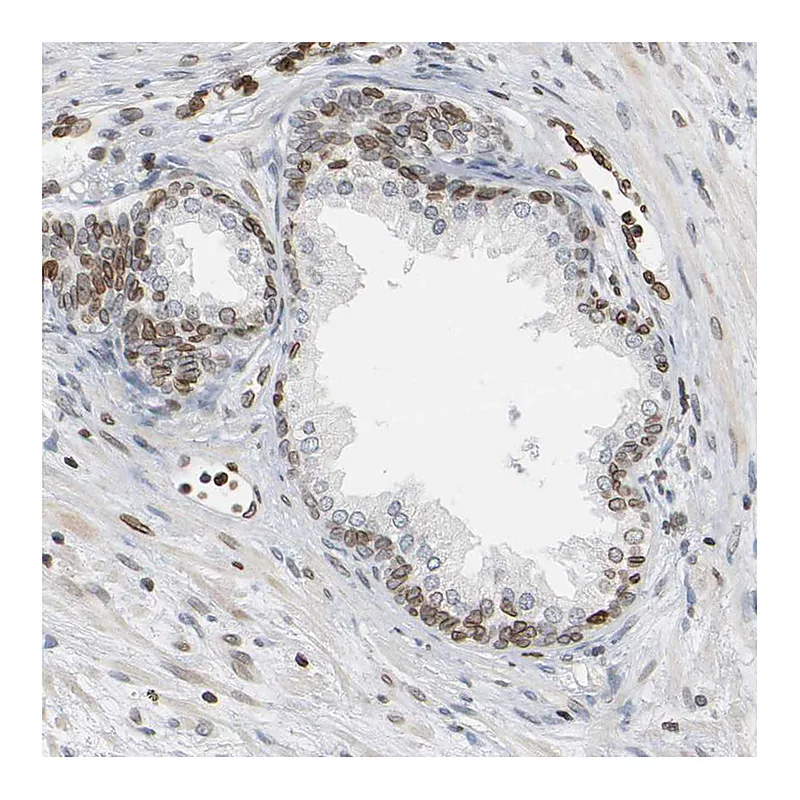 Atlas Antibodies Anti-PRKAG2 Antibody