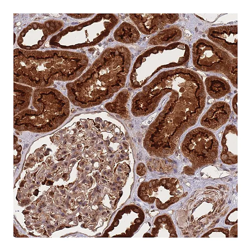 Atlas Antibodies Anti-PRKAR2A Antibody