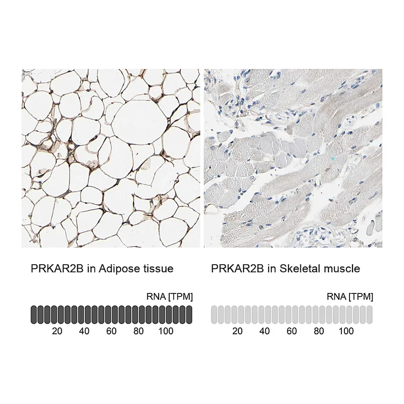 Atlas Antibodies Anti-PRKAR2B Antibody