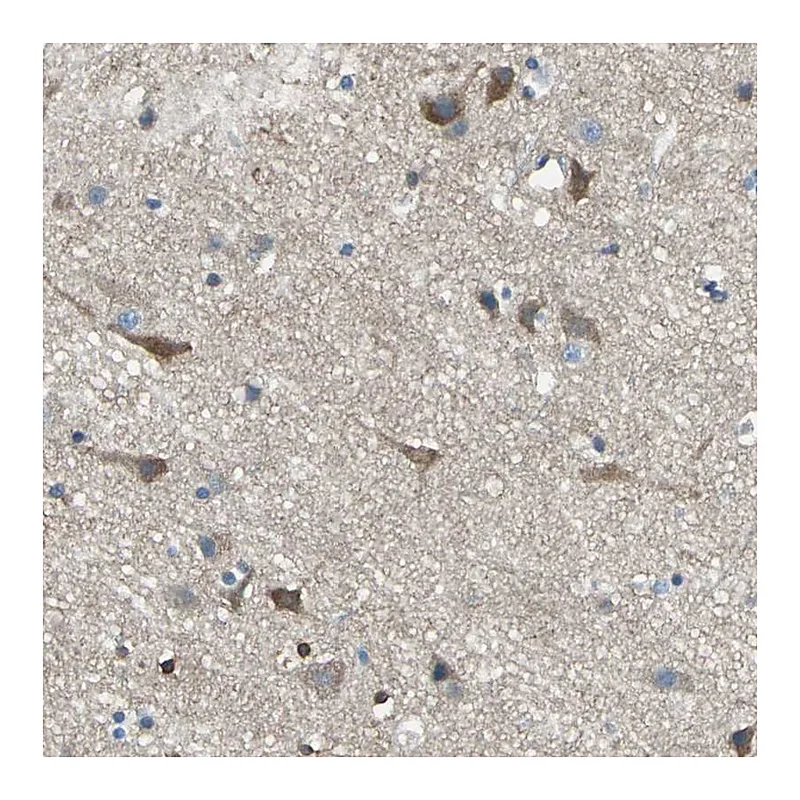 Atlas Antibodies Anti-PRKCA Antibody