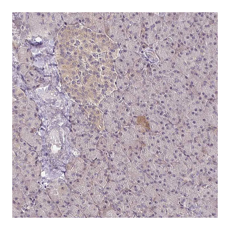 Atlas Antibodies Anti-PRKCB Antibody
