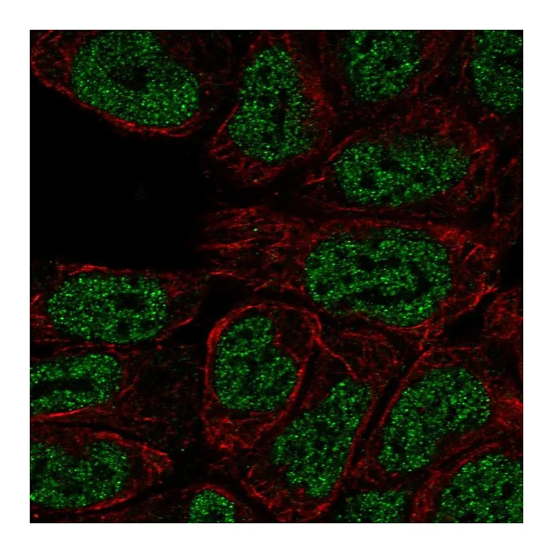 Atlas Antibodies Anti-PRKCB Antibody