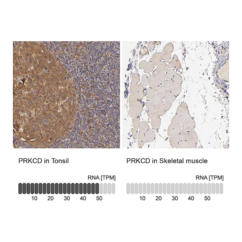 Atlas Antibodies Anti-PRKCD Antibody