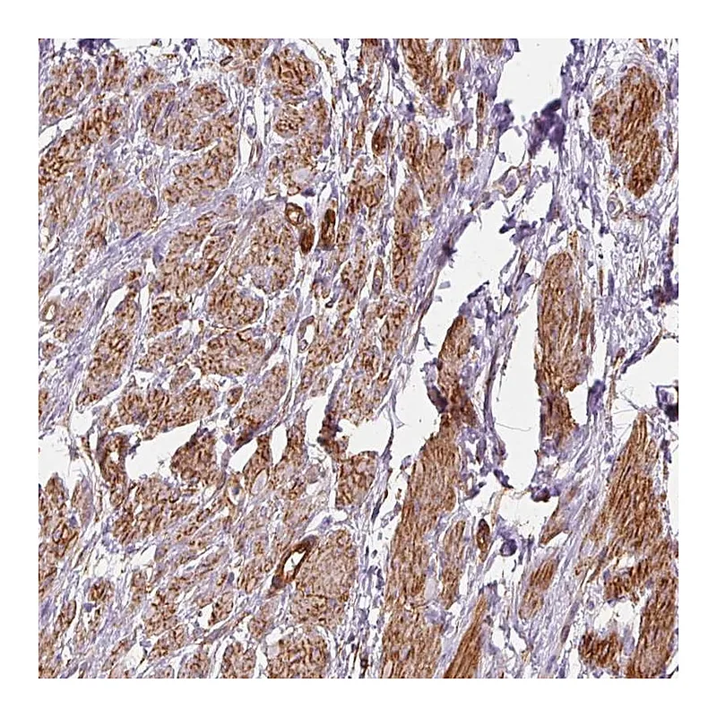 Atlas Antibodies Anti-PRKCDBP Antibody
