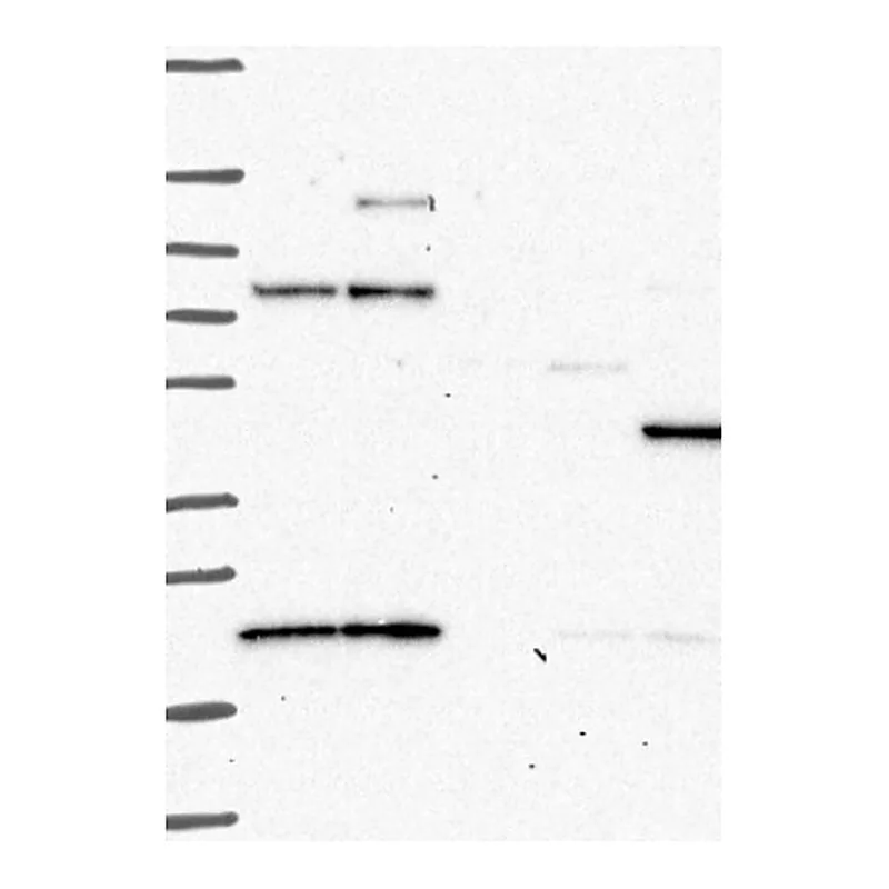 Atlas Antibodies Anti-PRKAR2B Antibody