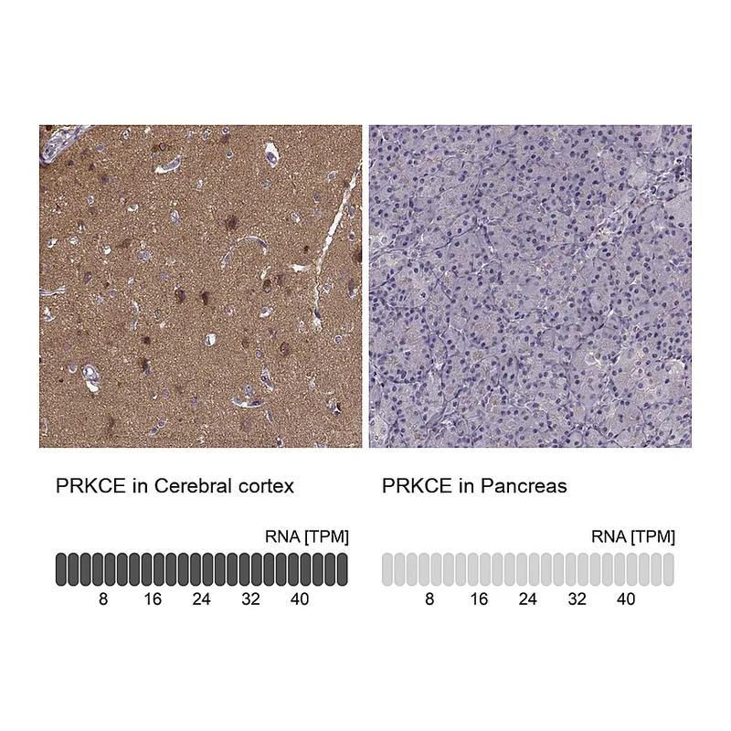 Atlas Antibodies Anti-PRKCE Antibody