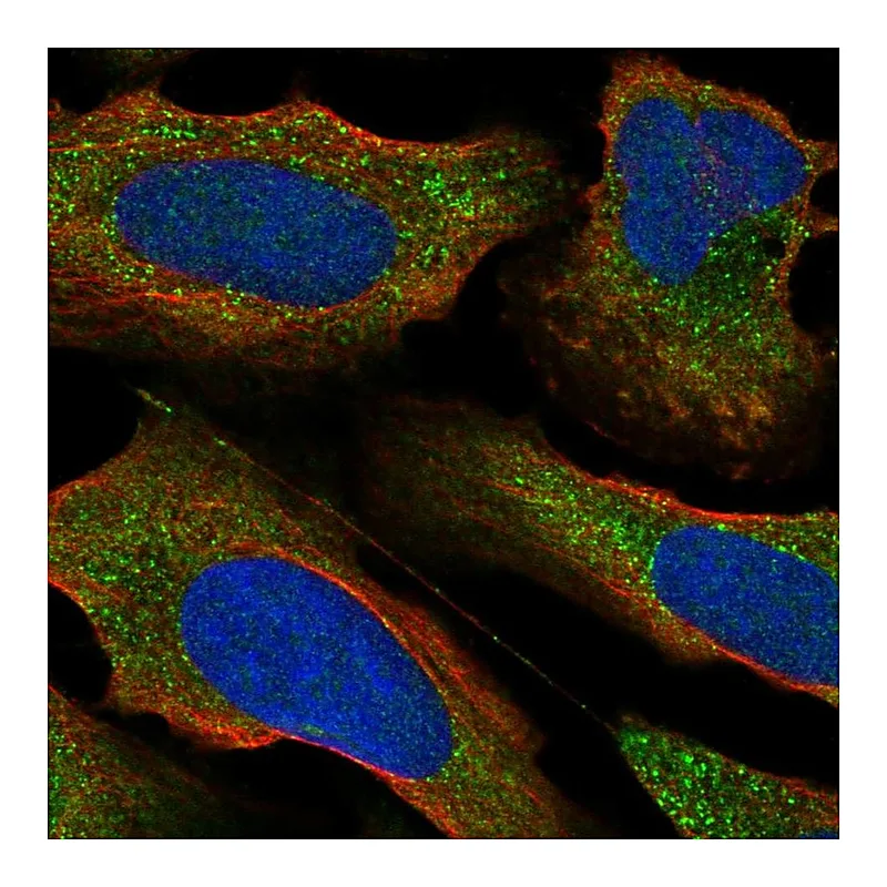 Atlas Antibodies Anti-PRKCE Antibody