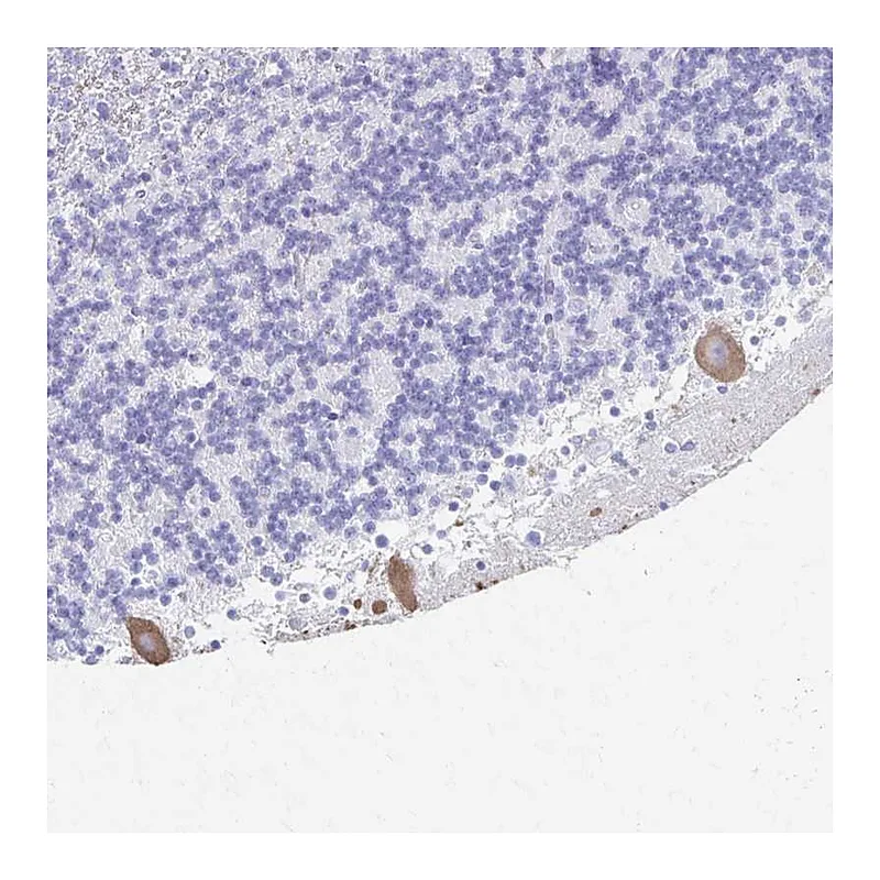 Atlas Antibodies Anti-PRKCG Antibody