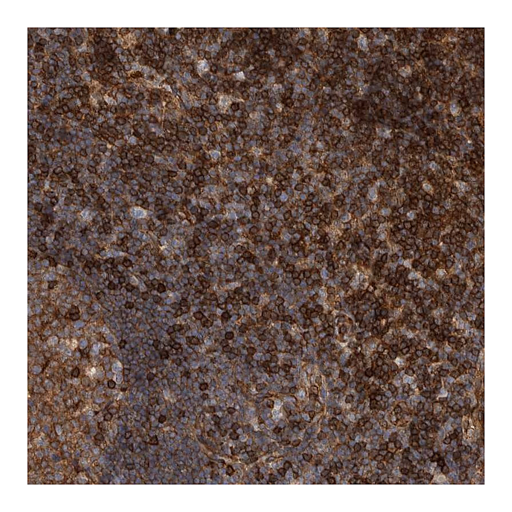 Atlas Antibodies Anti-PRKCH Antibody