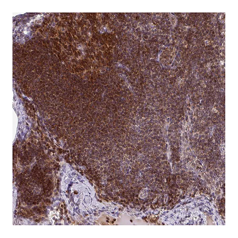 Atlas Antibodies Anti-PRKCH Antibody