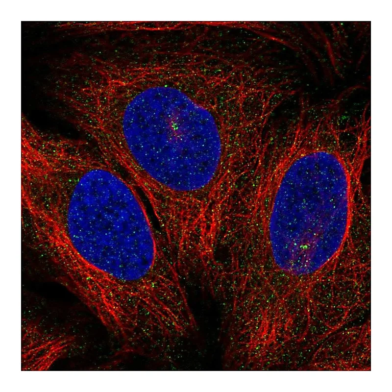 Atlas Antibodies Anti-PRKCQ Antibody