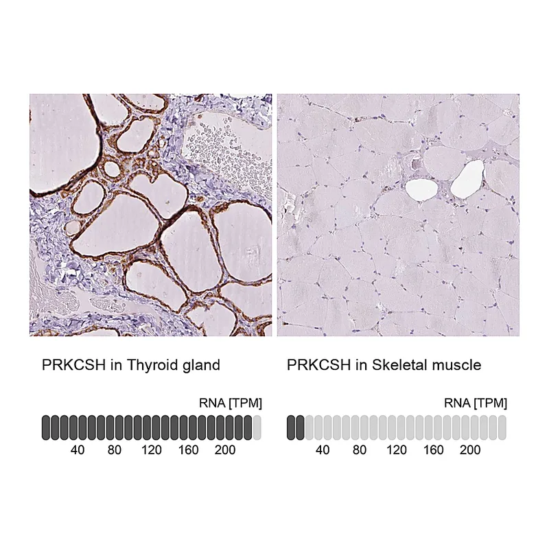 Atlas Antibodies Anti-PRKCSH Antibody