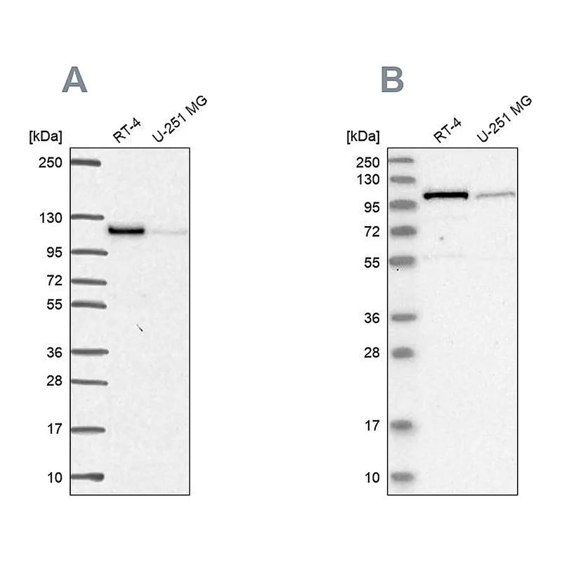 Atlas Antibodies Anti-PRKD2 Antibody