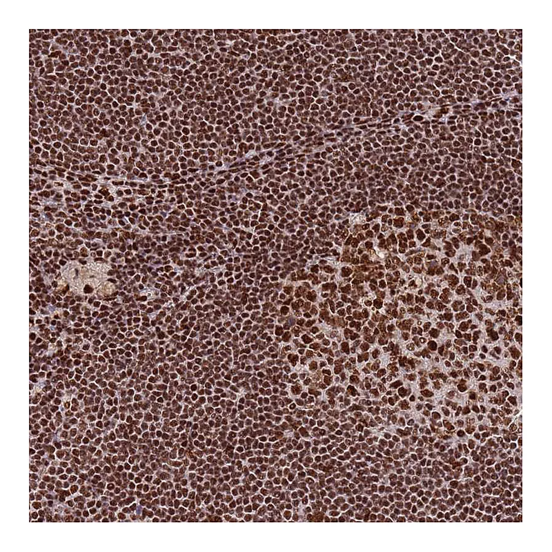 Atlas Antibodies Anti-PRKDC Antibody