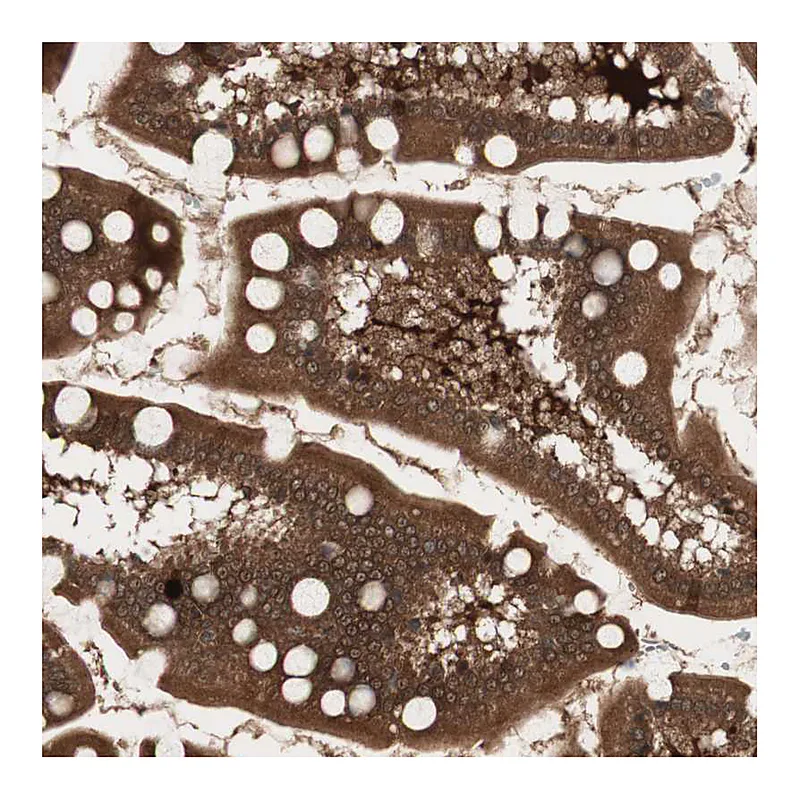 Atlas Antibodies Anti-PRKG2 Antibody