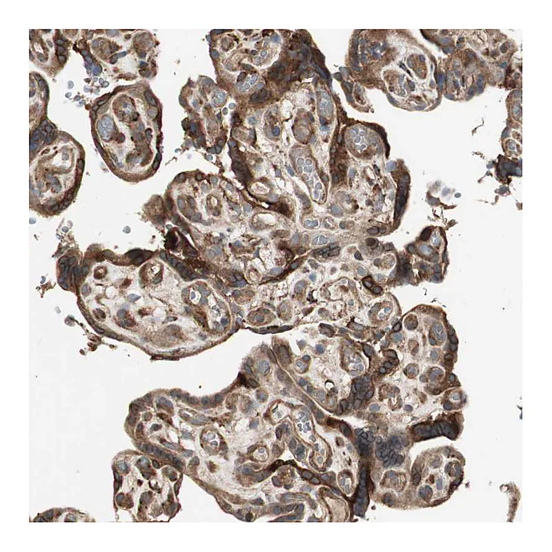 Atlas Antibodies Anti-PRKG1 Antibody