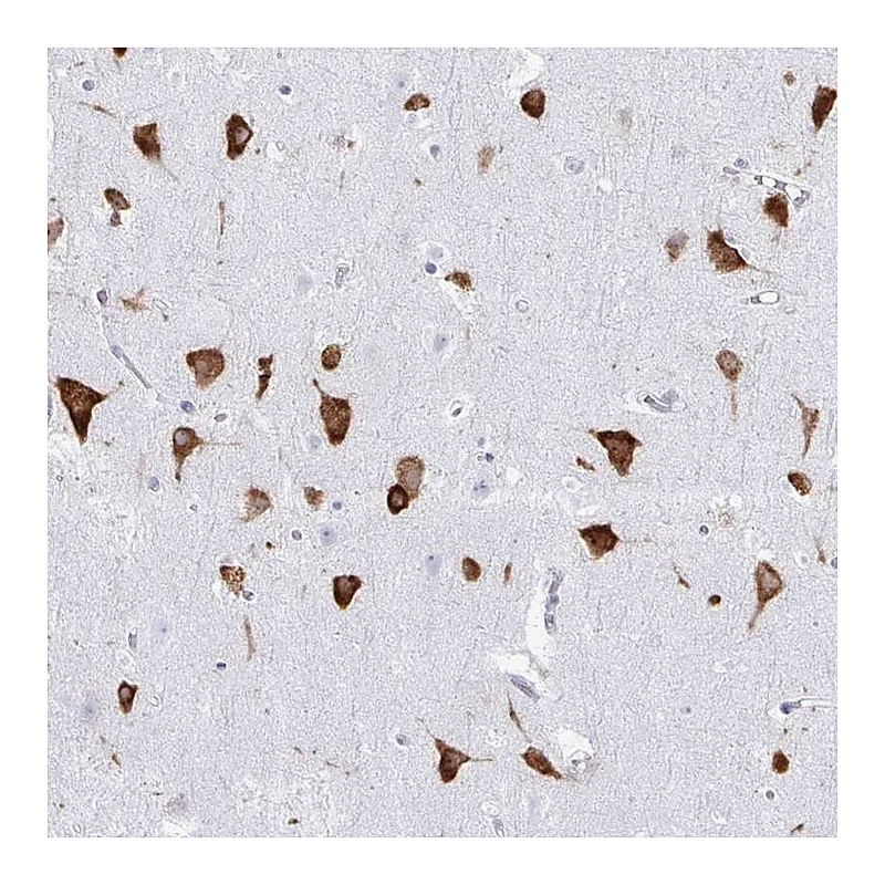 Atlas Antibodies Anti-PRKRA Antibody