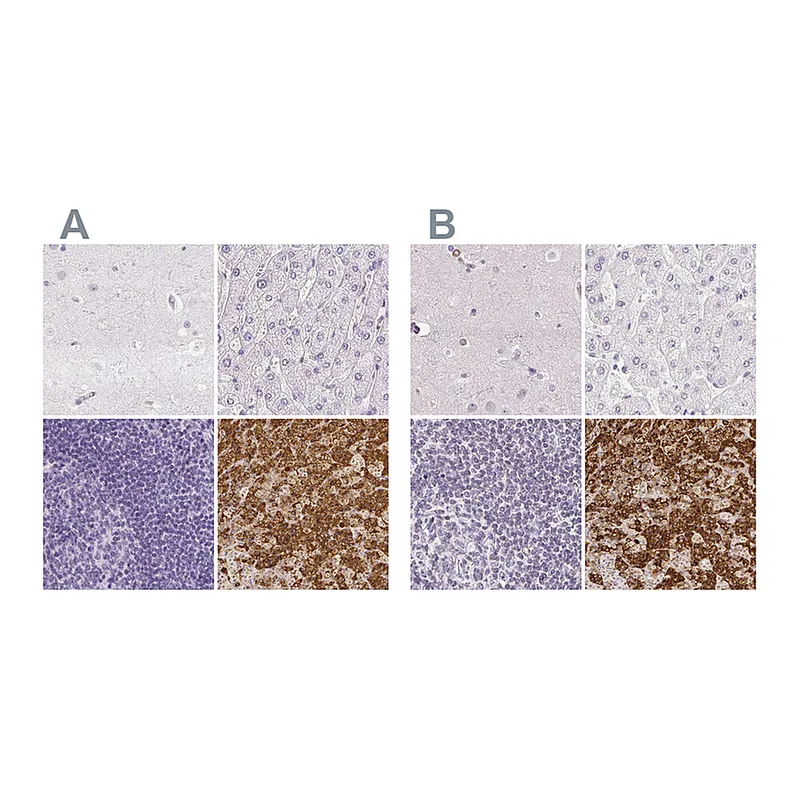 Atlas Antibodies Anti-PRL Antibody