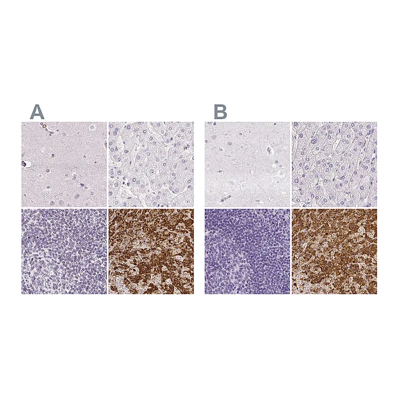 Atlas Antibodies Anti-PRL Antibody