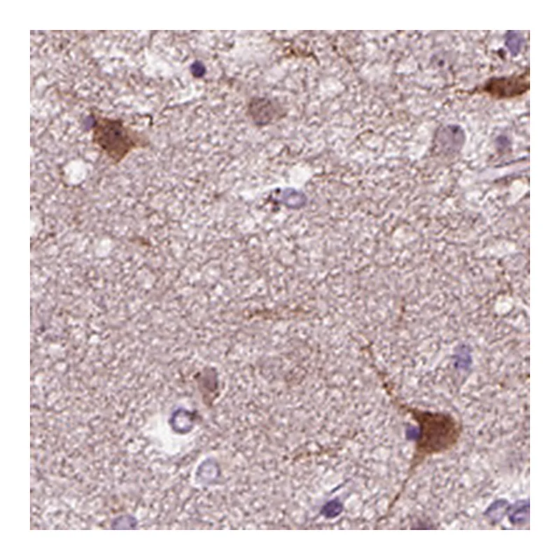 Atlas Antibodies Anti-PRLH Antibody