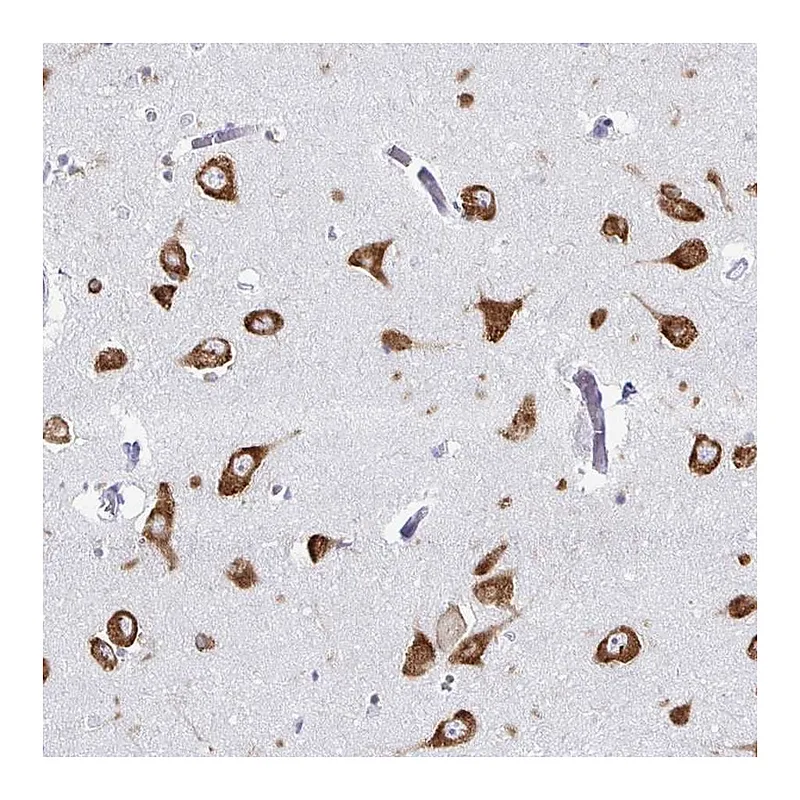Atlas Antibodies Anti-PRKRA Antibody
