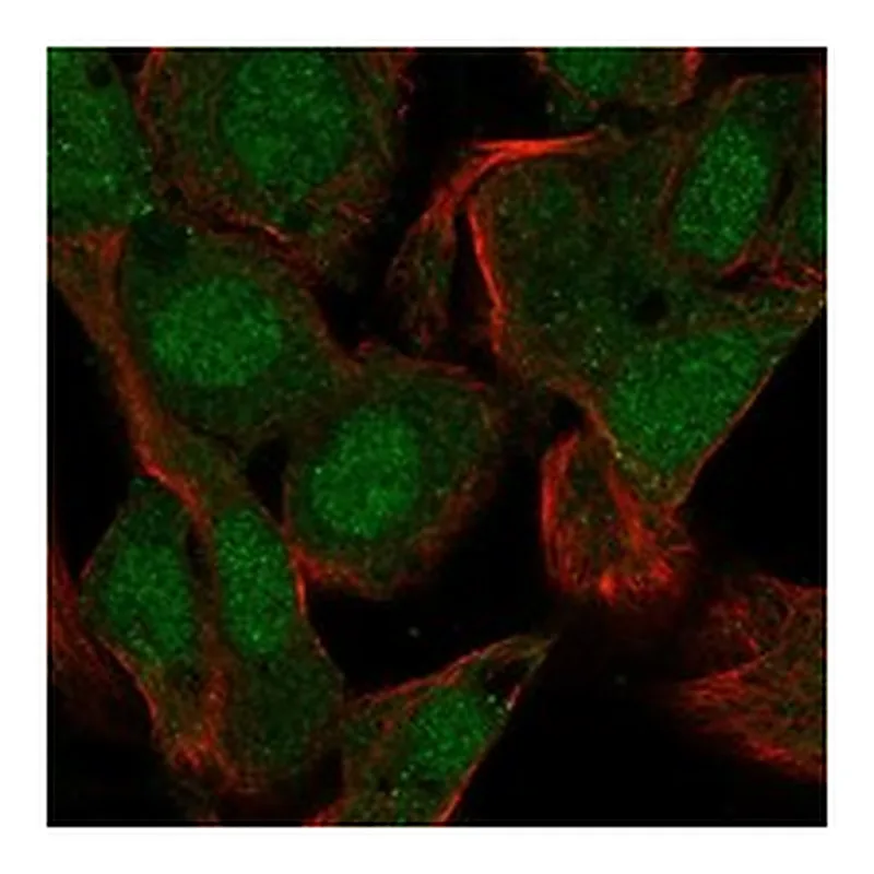 Atlas Antibodies Anti-PRM1 Antibody