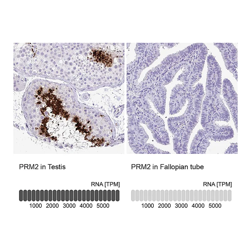 Atlas Antibodies Anti-PRM2 Antibody