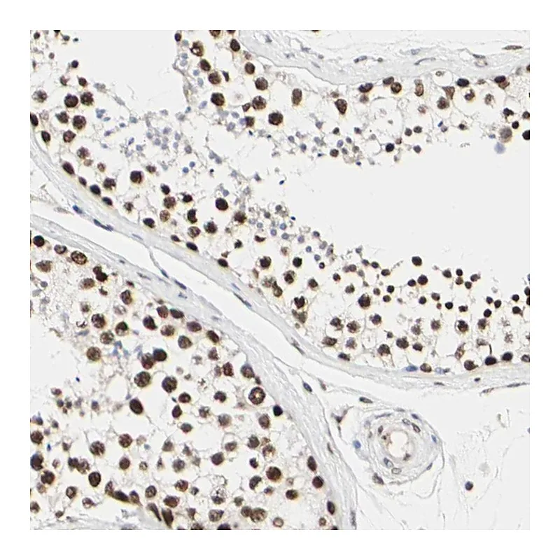 Atlas Antibodies Anti-PRMT3 Antibody