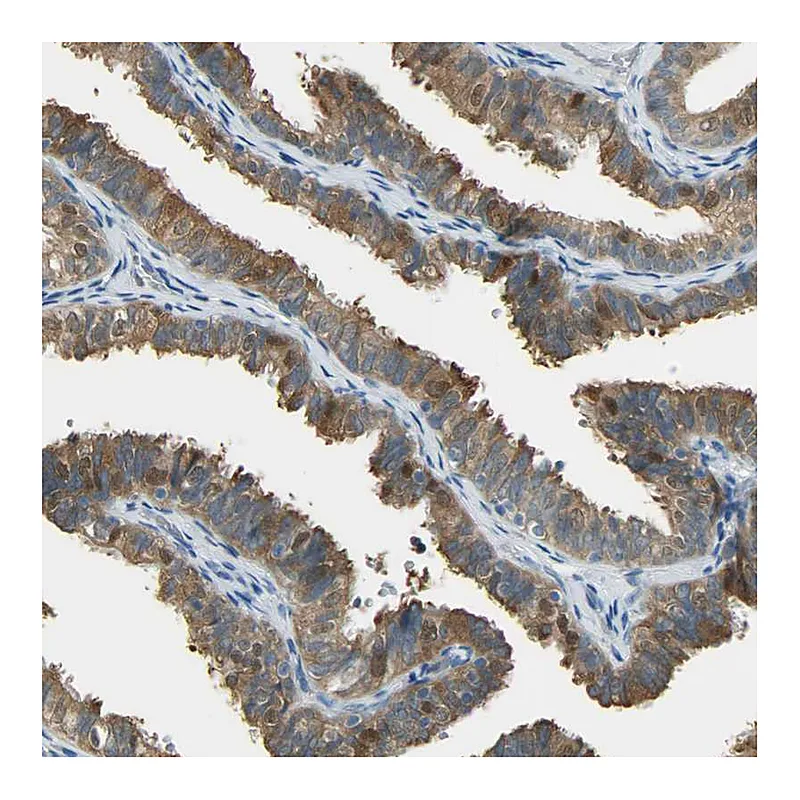 Atlas Antibodies Anti-PRMT5 Antibody