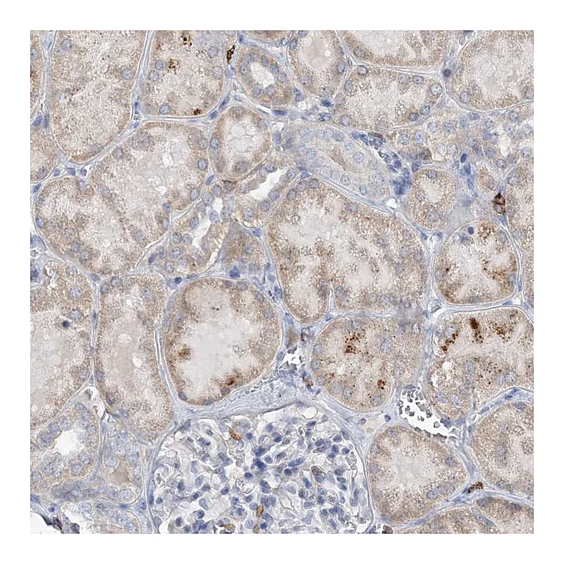 Atlas Antibodies Anti-PRMT9 Antibody