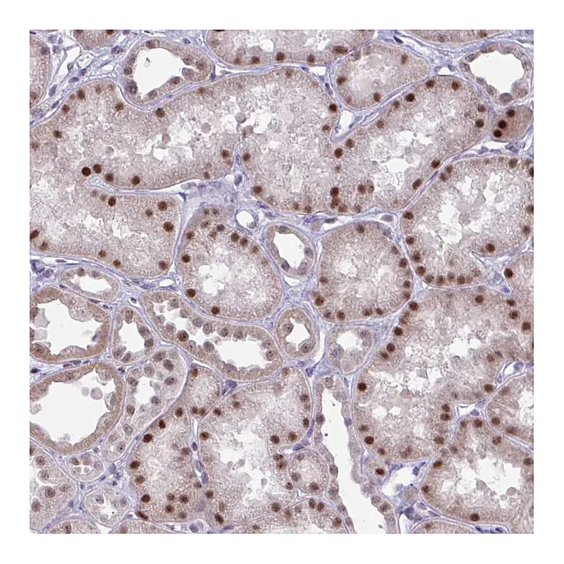 Atlas Antibodies Anti-PRMT6 Antibody