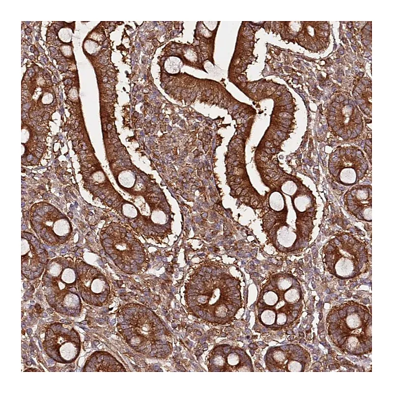 Atlas Antibodies Anti-PRMT7 Antibody