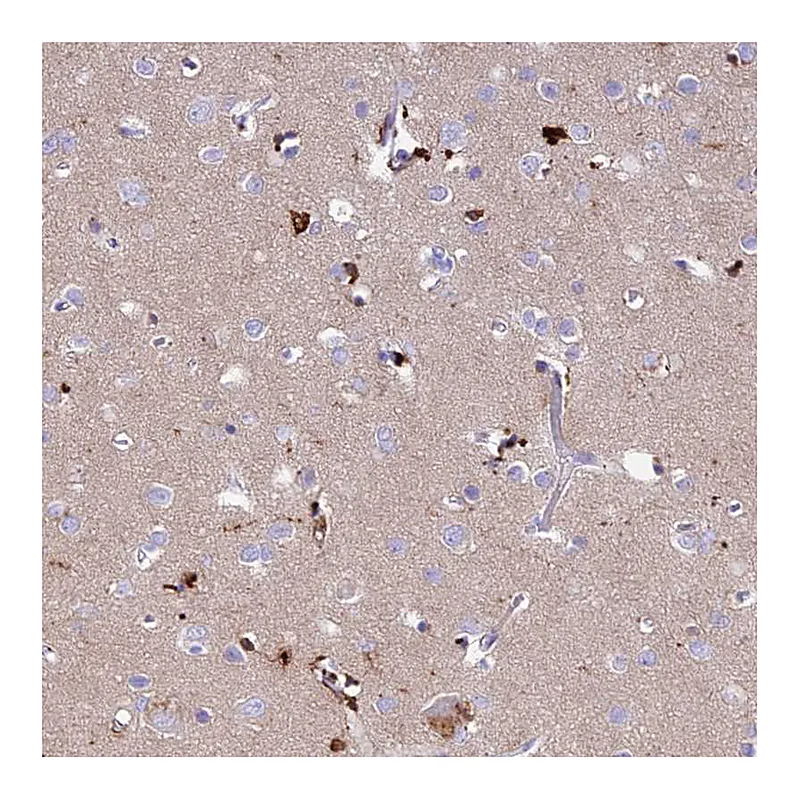 Atlas Antibodies Anti-PRNP Antibody