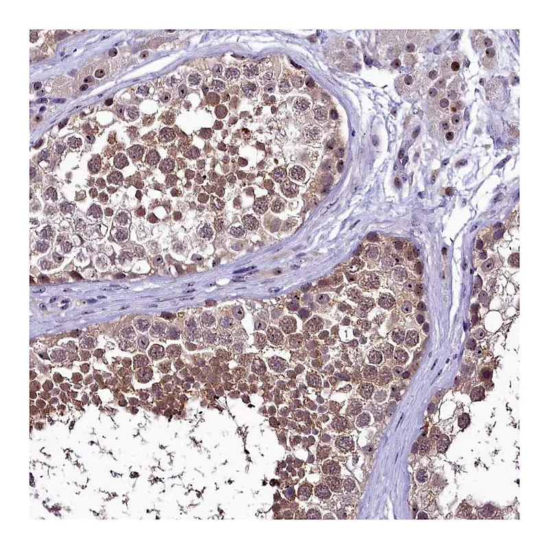 Atlas Antibodies Anti-PRNT Antibody
