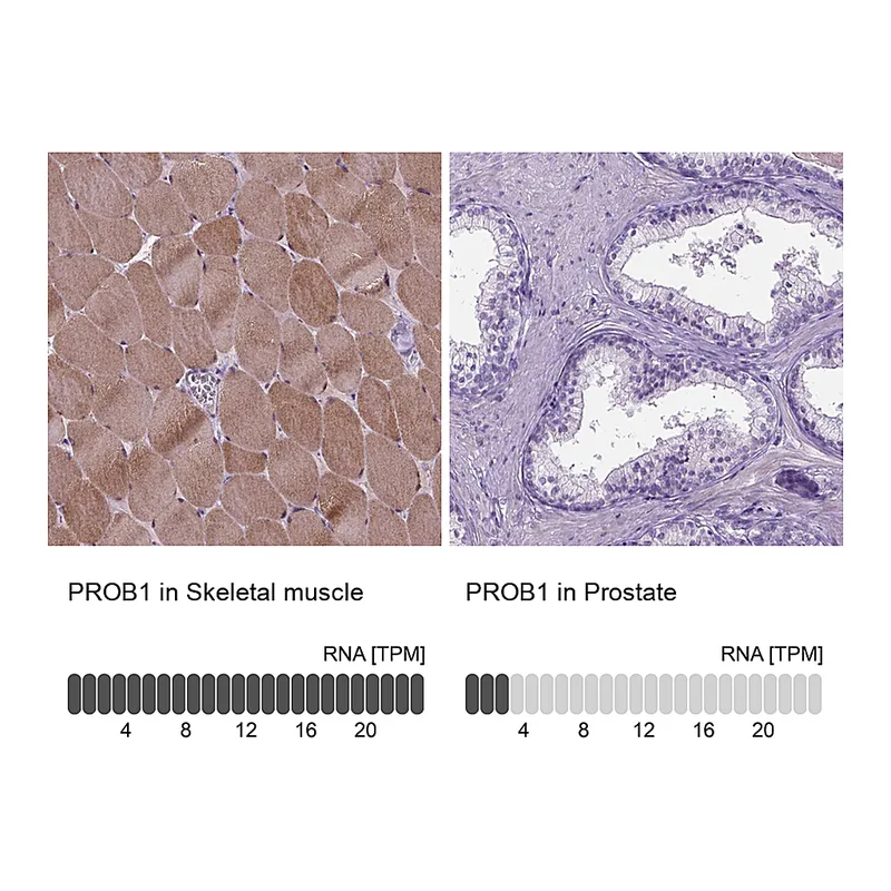 Atlas Antibodies Anti-PROB1 Antibody