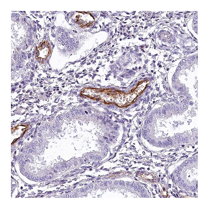 Atlas Antibodies Anti-PROCR Antibody