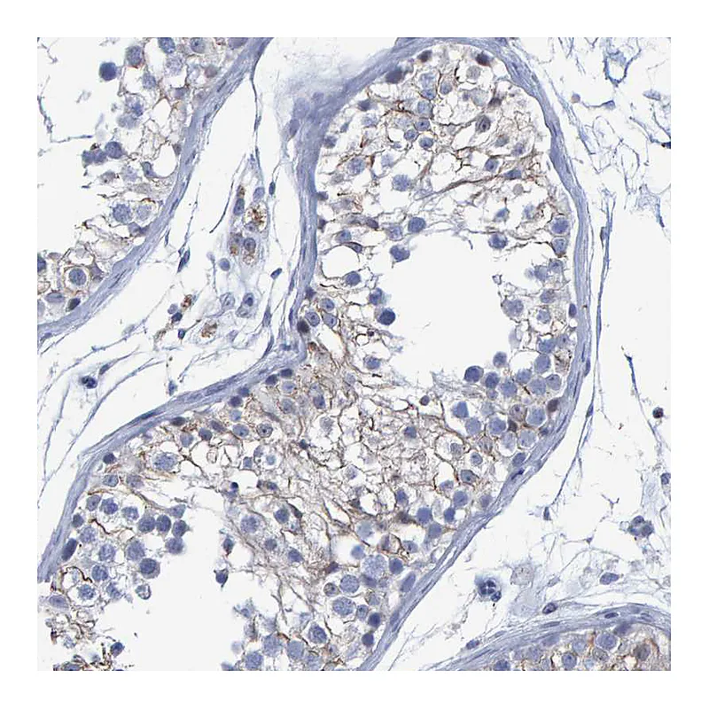 Atlas Antibodies Anti-PROCA1 Antibody