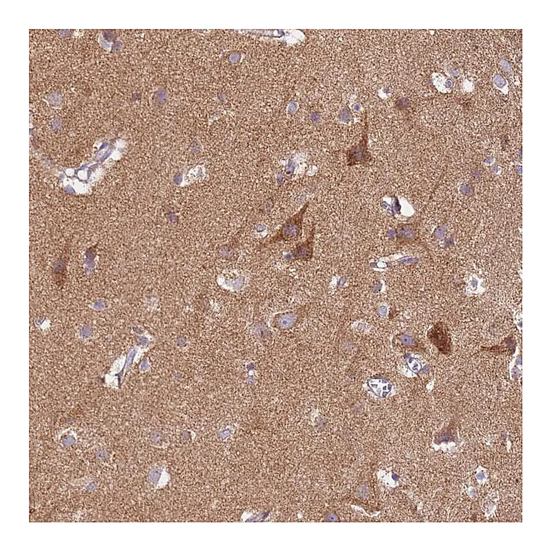Atlas Antibodies Anti-PROKR2 Antibody