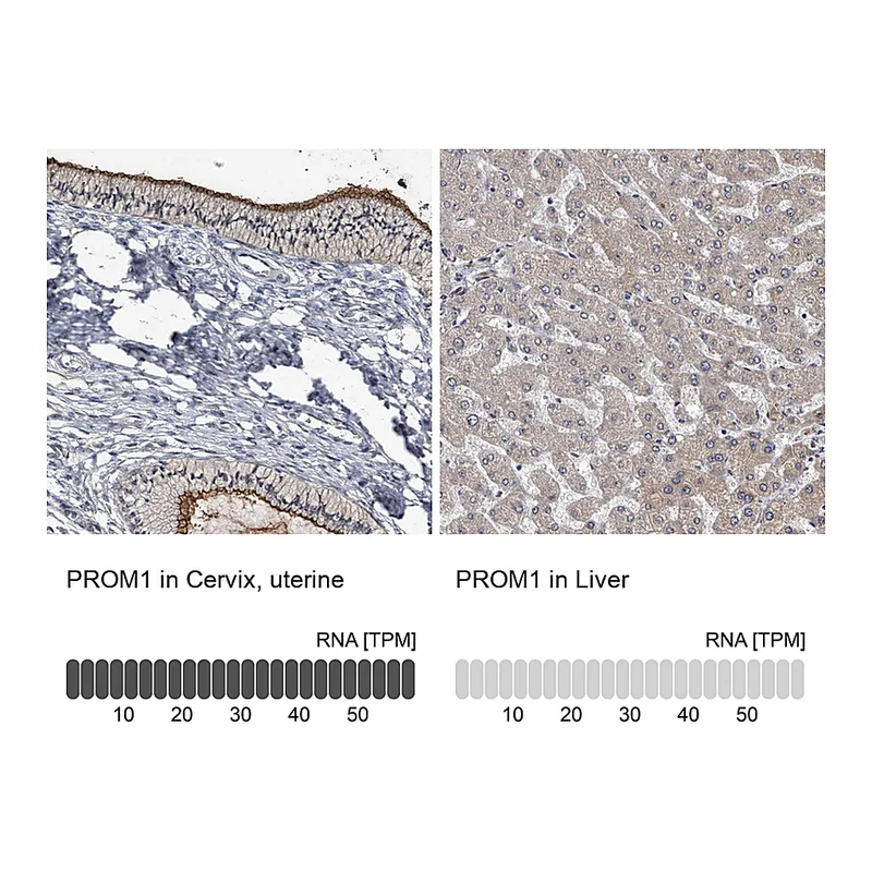 Atlas Antibodies Anti-PROM1 Antibody