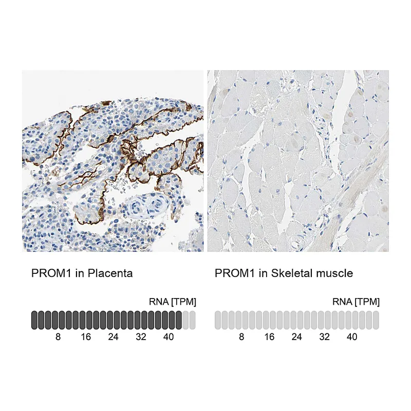 Atlas Antibodies Anti-PROM1 Antibody