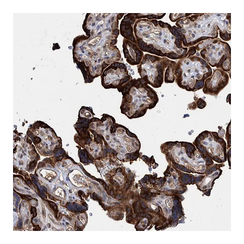 Atlas Antibodies Anti-PROSC Antibody