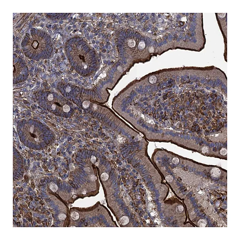 Atlas Antibodies Anti-PROSER2 Antibody
