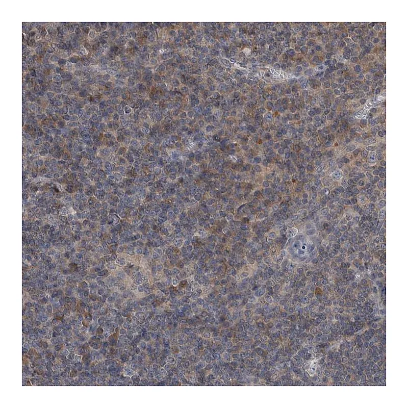 Atlas Antibodies Anti-PROSC Antibody