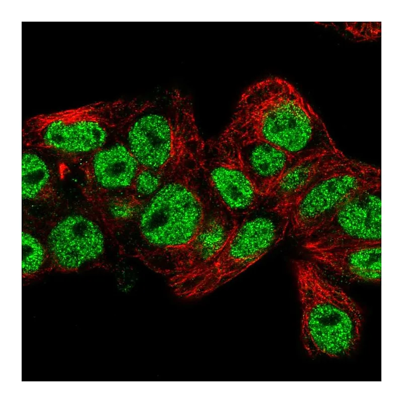 Atlas Antibodies Anti-PROX1 Antibody