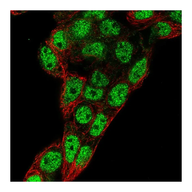 Atlas Antibodies Anti-PROX1 Antibody