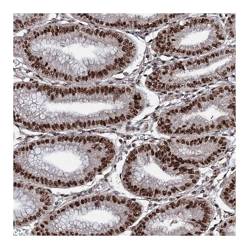Atlas Antibodies Anti-PRPF18 Antibody